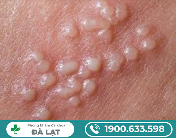 Hình ảnh minh họa